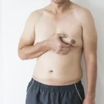 Moobs are more common than people think