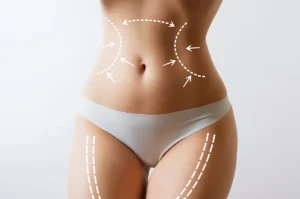 Why Vaser liposuction is such a popular procedure?
