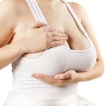 Why It’s Important To Choose The Right Surgeon For Breast Reduction