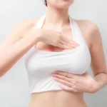 What To Expect from Breast Reconstruction Surgery and How A Tissue Expander Works