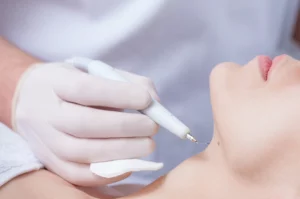 Everything You Need To Know About Laser Mole Removal