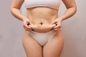 What to do after liposuction