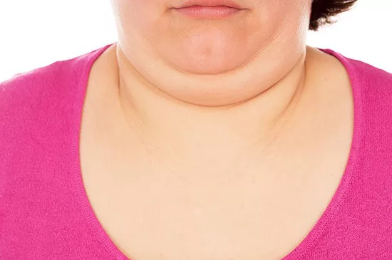 double-chin-lipo-in-manchester
