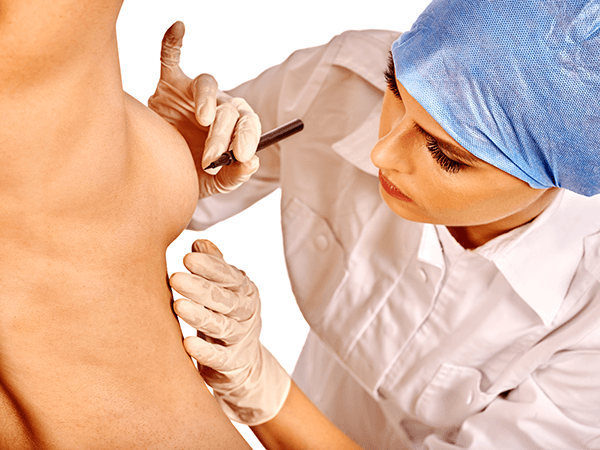 nipple correction c3