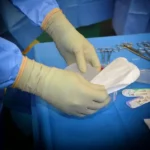 Surgeon Conducting Breast Re-Augmentation Surgery