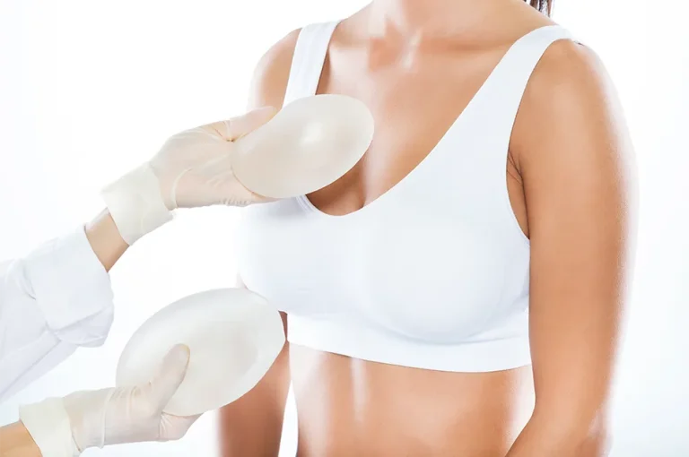 breast implants
