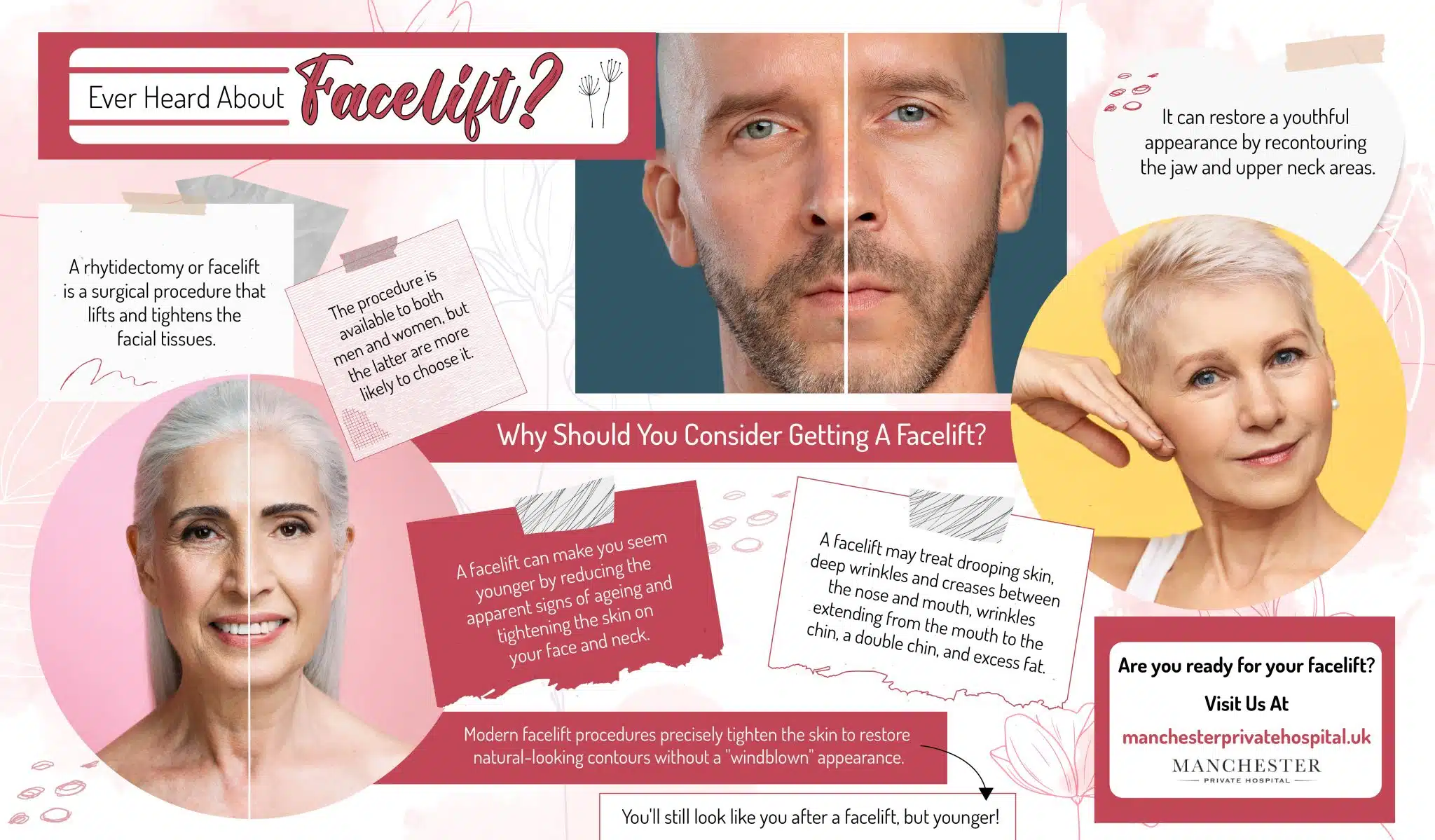 Ever Heard About Facelift?