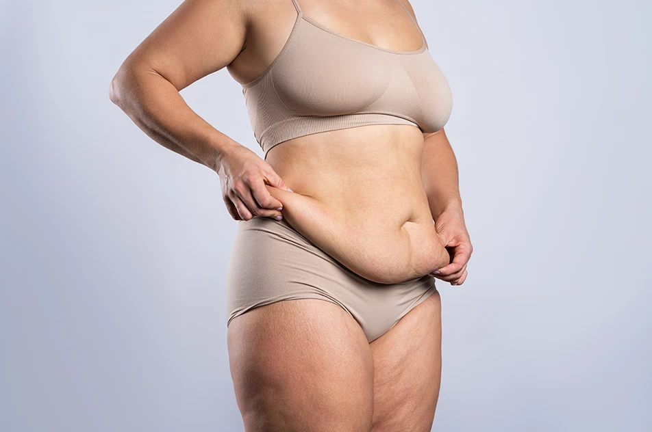 a woman pinching loose skin on her lower abdomen