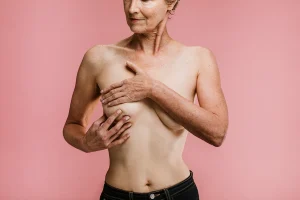 Types and Expectations of Mastopexy Scars Revealed