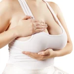 Sagging Breast: Causes, Grades & When to Seek Treatment