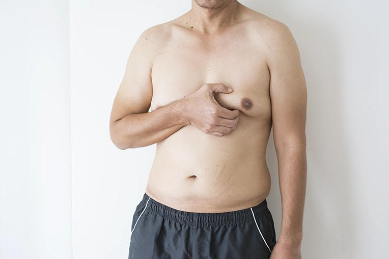 Close view of man checking chest for gynecomastia symptoms.