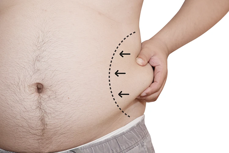 Close-up of male waist showing love handle fat marked as a treatment area