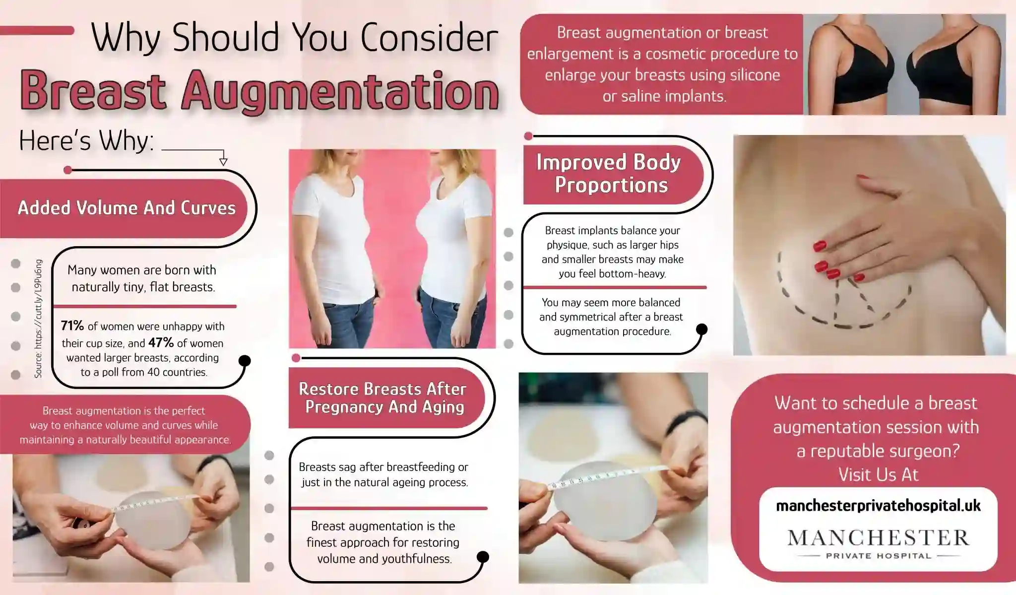 Breast Augmentation